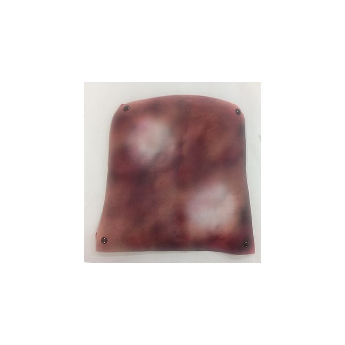 Simulaids Burn Back 2Nd & 3Rd Degree