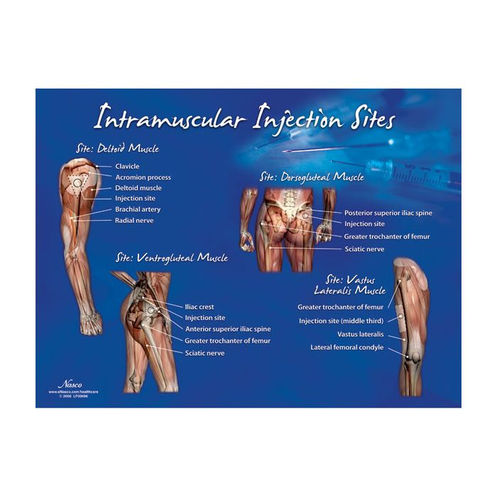 IM Injection Sites Chart