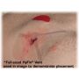  HyFin Vent Compact Chest Seal Twin Pack