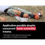 STS-C  Slishman Compact Traction Splint