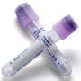 Vacutainer® EDTA Tubes Plastic K2EDTA Lavender 13 x 75 4.0m 100. Box