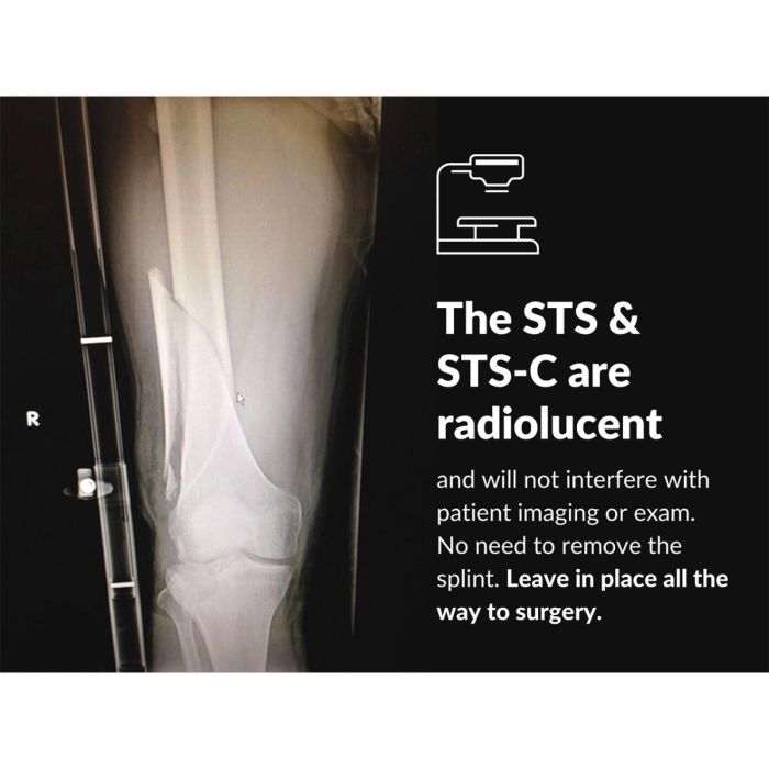 STS-C  Slishman Compact Traction Splint