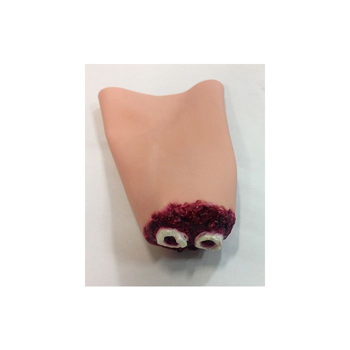 Simulaids Hand Amputation