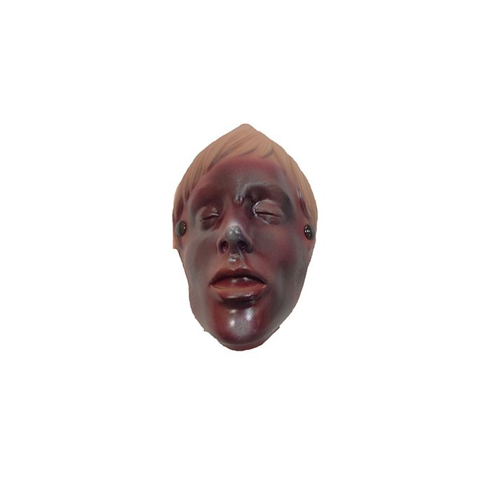 Simulaids Burn Of The Face African-American (Manikin Use Only)