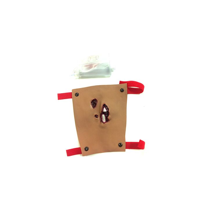 Simulaids Tibia /Compound Fracture African-American