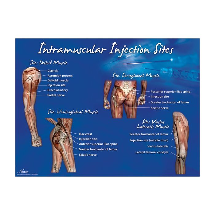 IM Injection Sites Set IM Injection Sites Set