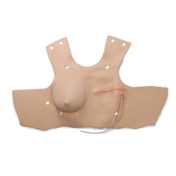 Mastectomy Module