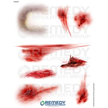 Moulage Tattoos - Patient B Scenario. Qty: 4.