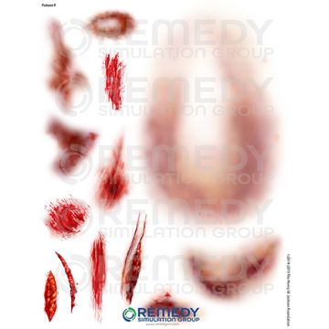 Moulage Tattoos - Patient F Scenario. Qty: 2.