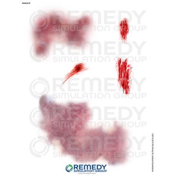 Moulage Tattoos - Patient H Scenario. Qty: 1.