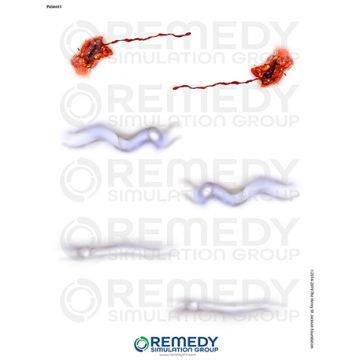 Moulage Tattoos - Patient I Scenario. Qty: 1.
