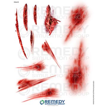 Moulage Tattoos - Patient K Scenario. Qty: 6.