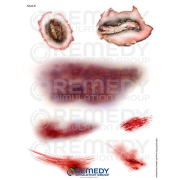 Moulage Tattoos - Patient M Scenario. Qty: 2.