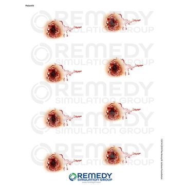 Moulage Tattoos - Patient N Scenario. Qty: 1.