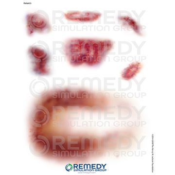 Moulage Tattoos - Patient S Scenario. Qty: 4.