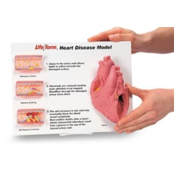 ART/HEART DISEASE 3D DSPLY